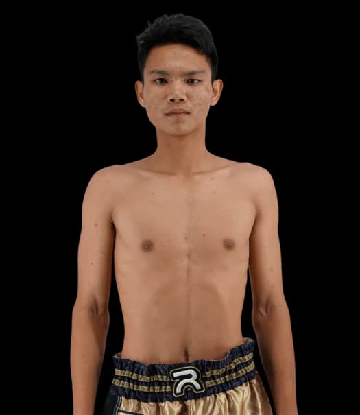 Superchamp